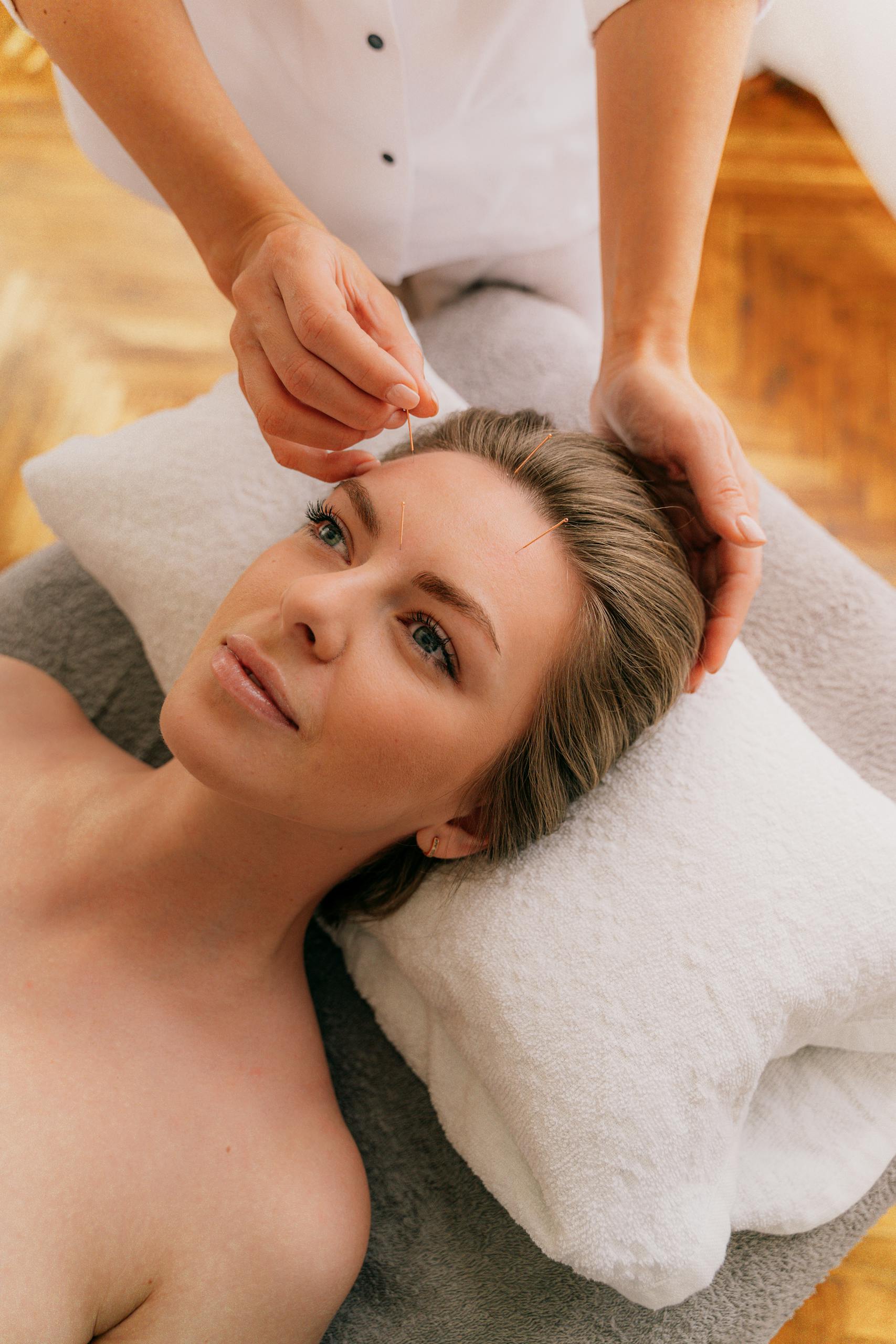 A serene acupuncture session with a woman lying peacefully on a massage table.