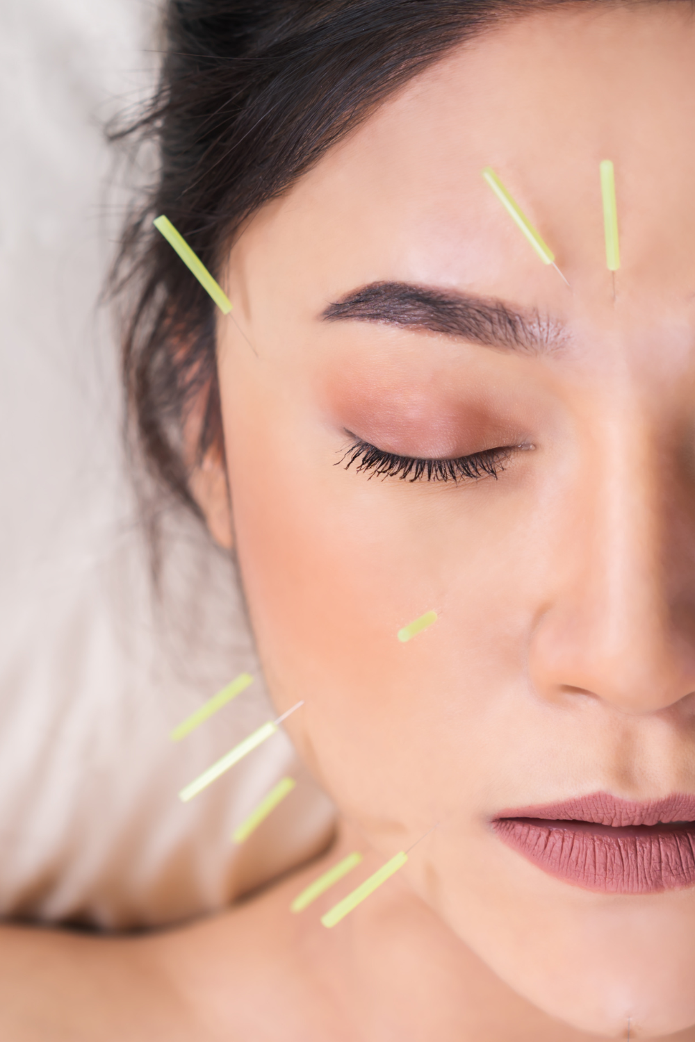 facial rejuvenation