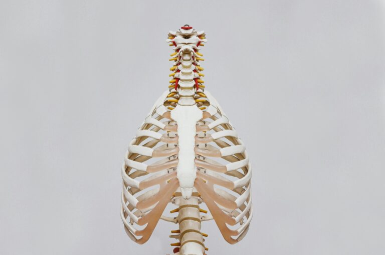 Rib Dysfunction: Why It Hurts to Breathe and How Physiotherapy Helps